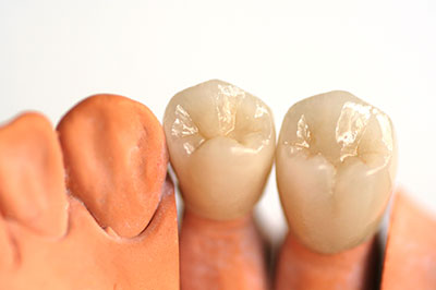 Granger Dentistry | E4D, Botox reg  and Cosmetic Dentistry