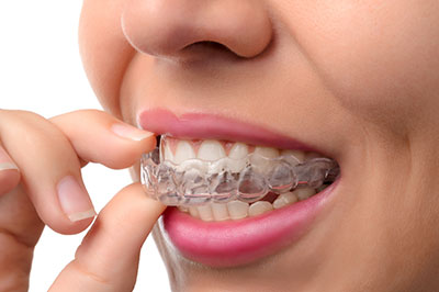 Granger Dentistry | Dental Lab, Dental Cleanings and Snoring Appliances
