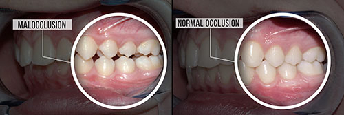 Granger Dentistry | Dentures, ClearCorrect reg  and Dental Lab