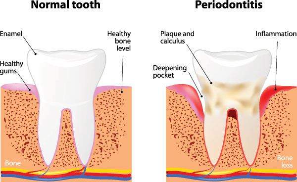 Granger Dentistry | VELscope reg  Cancer Screening, Cosmetic Dentistry and LANAP reg 