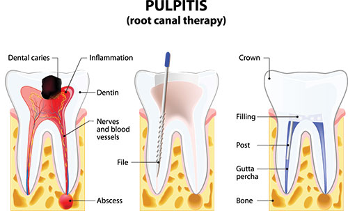 Granger Dentistry | Implant Dentistry, Orthodontics and Sedation Dentistry