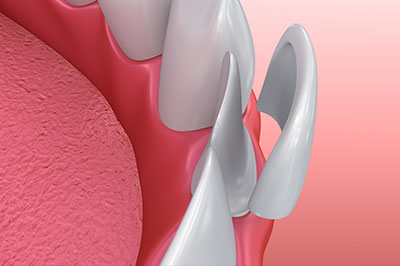 Granger Dentistry | Root Canals, Dentures and Oral Cancer Screening
